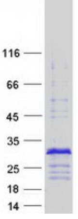 SDS-PAGE (CRIP2-2769H).jpg